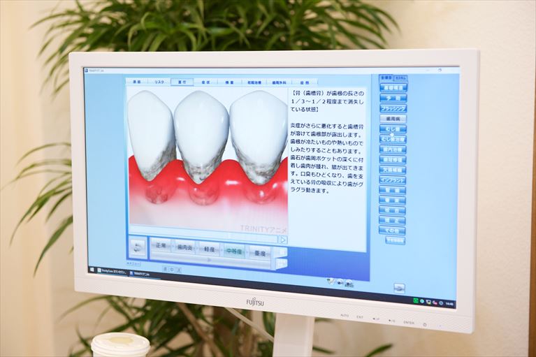 このような症状が1つでもある方は、歯周病かもしれません